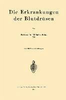 Die Erkrankungen der Blutdrüsen (eBook, PDF) - Falta, Wilhelm