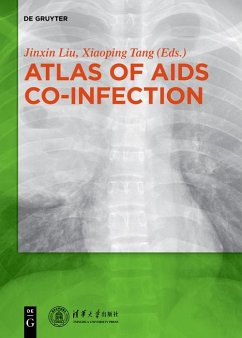 Atlas of AIDS Co-infection (eBook, ePUB)