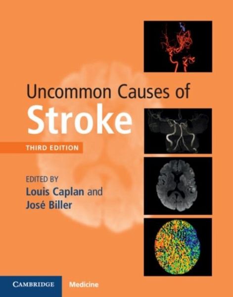 Uncommon Causes of Stroke (eBook, PDF) Uncommon Causes of Stroke (eBook, PDF)