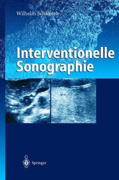 Interventionelle Sonographie (eBook, PDF) Interventionelle Sonographie (eBook, PDF)