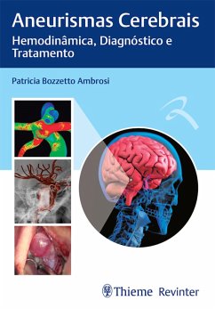 Aneurismas Cerebrais (eBook, ePUB) - Ambrosi, Patricia Bozzetto