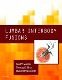 Lumbar Interbody Fusions E-Book (eBook, ePUB)