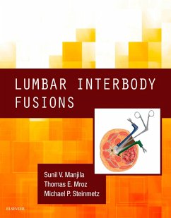 Lumbar Interbody Fusions E-Book (eBook, ePUB) - Manjila, Sunil V; Mroz, Thomas; Steinmetz, Michael P