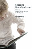 Choosing Down Syndrome (eBook, ePUB)