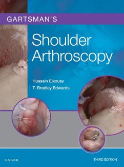 Gartsman's Shoulder Arthroscopy E-Book (eBook, ePUB) - Elkousy, Hussein; Edwards, T. Bradley