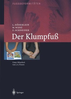 Der Klumpfuss (eBook, PDF) - Döderlein, Leonhard; Wenz, Wolfram; Schneider, Urs