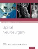 Spinal Neurosurgery