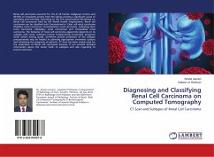 Diagnosing and Classifying Renal Cell Carcinoma on Computed Tomography