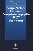 Single-Photon-Emissions-Computertomographie (SPECT) des Herzens (eBook, PDF)