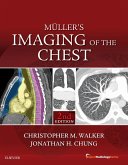 Muller's Imaging of the Chest E-Book (eBook, ePUB)