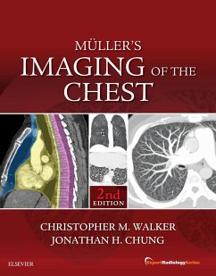 Muller's Imaging of the Chest E-Book (eBook, ePUB) - Walker, Christopher M.; Chung, Jonathan H.