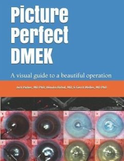 Picture Perfect DMEK: A visual guide to a beautiful operation - Birbal, Rénuka; Melles, Gerrit; Parker, Jack