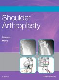Shoulder Arthroplasty E-Book (eBook, ePUB)