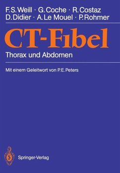 CT-Fibel (eBook, PDF) - Weill, Francis S.; Coche, Gilles; Costaz, Remy; Didier, Dominque; Le Mouel, Arlette; Rohmer, Paul