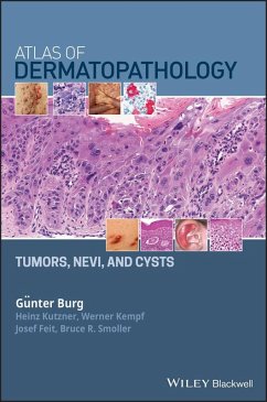 Atlas of Dermatopathology (eBook, ePUB) - Burg, Günter; Kutzner, Heinz; Kempf, Werner; Feit, Josef; Smoller, Bruce R.