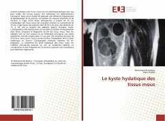 Le kyste hydatique des tissus mous - Kedous, Mohamed Ali;Chebbi, Wael