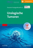Urologische Tumoren (eBook, ePUB)