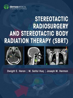Stereotactic Radiosurgery and Stereotactic Body Radiation Therapy (SBRT) (eBook, ePUB)
