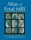 Atlas of Fetal MRI (eBook, PDF)