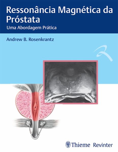 Ressonância Magnética da Próstata (eBook, ePUB)