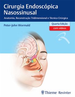Cover Cirurgia Endoscópica Nasossinusal (eBook, ePUB)