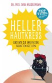 Heller Hautkrebs (eBook, ePUB)