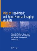 Atlas of Head/Neck and Spine Normal Imaging Variants (eBook, PDF)