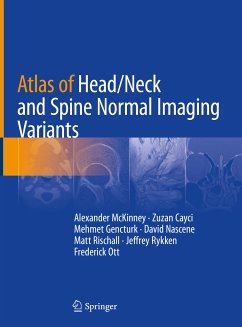 Atlas of Head/Neck and Spine Normal Imaging Variants (eBook, PDF) - McKinney, Alexander; Cayci, Zuzan; Gencturk, Mehmet; Nascene, David; Rischall, Matt; Rykken, Jeffrey; Ott, Frederick