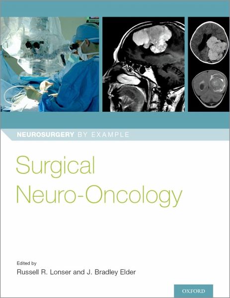 Surgical Neuro-Oncology (eBook, ePUB) Surgical Neuro-Oncology (eBook, ePUB)
