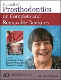 Journal of Prosthodontics on Complete and Removable Dentures (eBook, PDF)