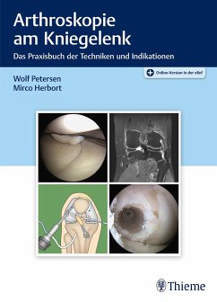 Arthroskopie am Kniegelenk - Petersen, Wolf;Herbort, Mirco