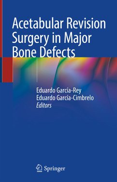 Acetabular Revision Surgery in Major Bone Defects (eBook, PDF)