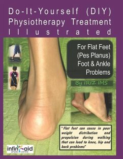 Physiotherapy Treatment Illustrated For Flat Feet (Pes Planus) Foot & Ankle Problems - Ims, Iriz