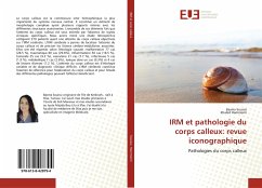 IRM et pathologie du corps calleux: revue iconographique - Souissi, Basma; Hammemi, Khaled
