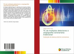 TC de múltiplos detectores e angiografia coronariana tradicional - Leite da Silva, Fabíola