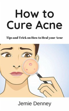 How to Cure Acne (eBook, ePUB) - Lindsey, Jessica