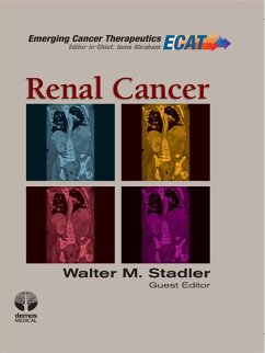 Cover Renal Cancer (eBook, ePUB)