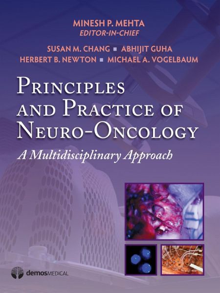 Principles & Practice of Neuro-Oncology (eBook, ePUB) Principles & Practice of Neuro-Oncology (eBook, ePUB)