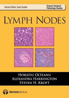 Lymph Nodes (eBook, ePUB) - Harrington, Alexandra; Kroft, Steven H.; Olteanu, Horatiu