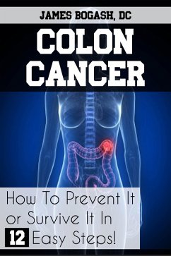 Colon Cancer: How to Prevent it or Survive it in 12 Easy Steps (eBook, ePUB) - Bogash, James