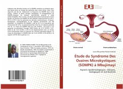 Étude du Syndrome Des Ovaires Microkystiques (SOMPK) à Mbujimayi - Mbuyamba Ntobo Kalenda, Louis