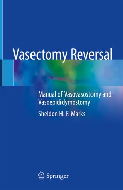 Vasectomy Reversal (eBook, PDF) - Marks, Sheldon H.F.