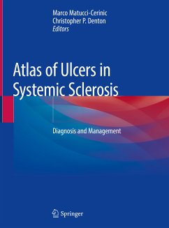 Atlas of Ulcers in Systemic Sclerosis (eBook, PDF)