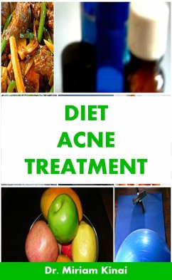 Cover Diet Acne Treatment (eBook, ePUB)