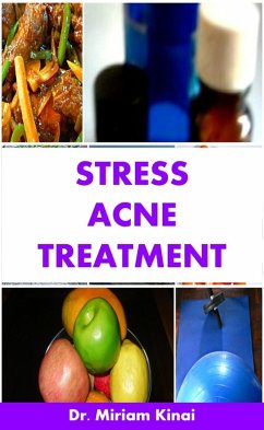 Cover Stress Acne Treatment (eBook, ePUB)