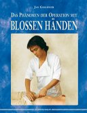 Das Phänomen der Operation mit blossen Händen (eBook, ePUB)