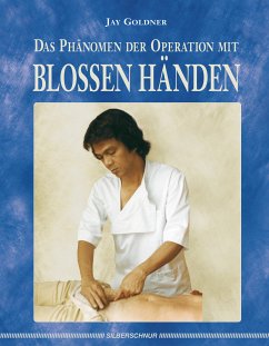 Das Phänomen der Operation mit blossen Händen (eBook, ePUB) - Goldner, Jay