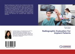 Radiographic Evaluation For Implant Patients - Parmar, Shivani;Gautam, Ankur