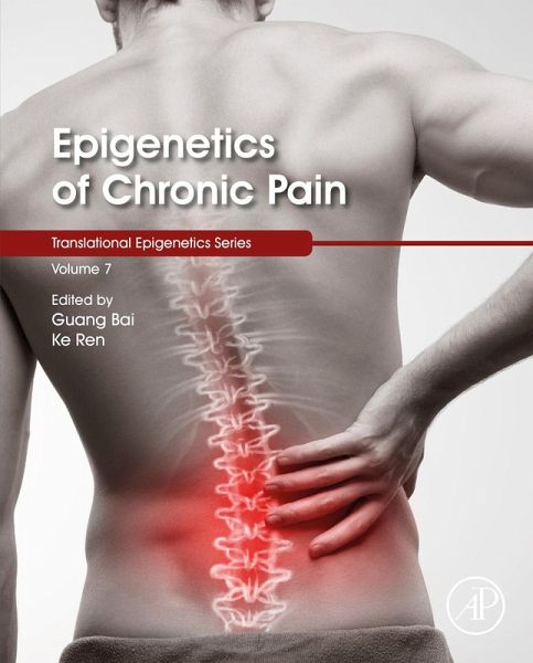 Epigenetics of Chronic Pain (eBook, ePUB) Epigenetics of Chronic Pain (eBook, ePUB)