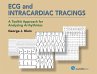 ECG and Intracardiac Tracings (eBook,... - Bild 1